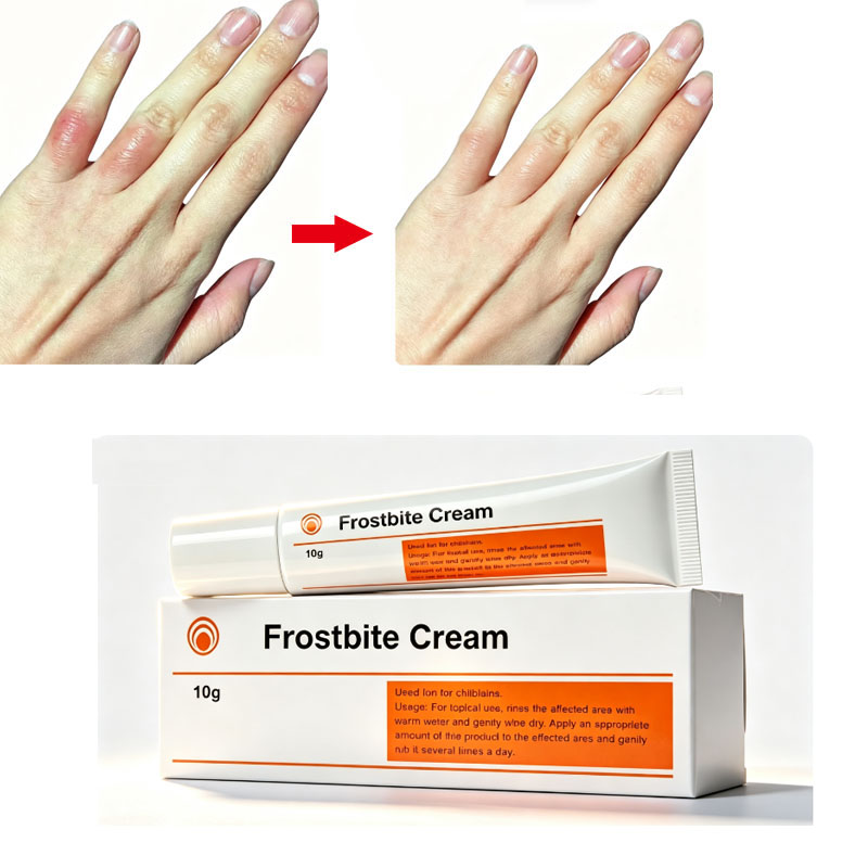 Skincare Natur E - Frostbite Cream 10g Natural Herbal Formula