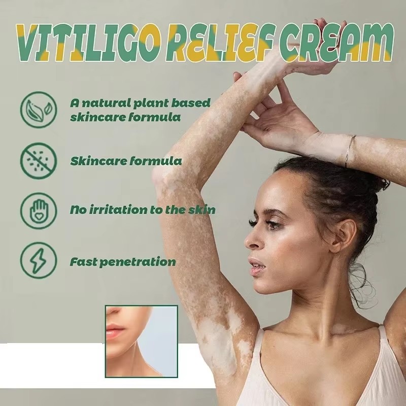 Effectively Remove Vitiligo Oi - Skincare China 评论和价格
