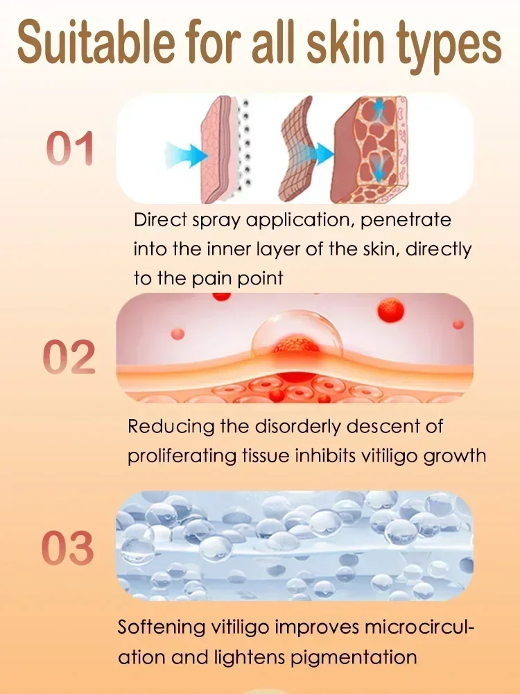 Effectively Remove Vitiligo Oi - Skincare China 评论和价格